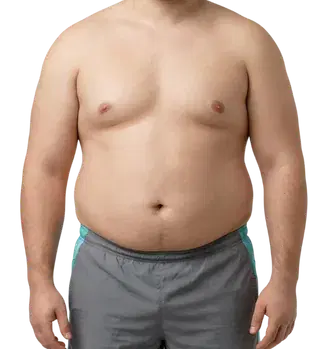 Corpulent